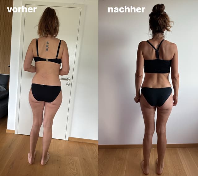 Vorher / Nachher – Rücken