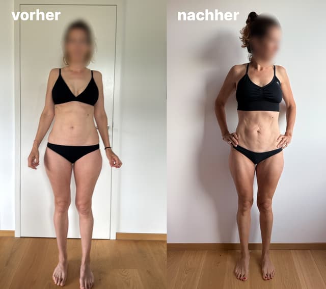 Vorher / Nachher – Front