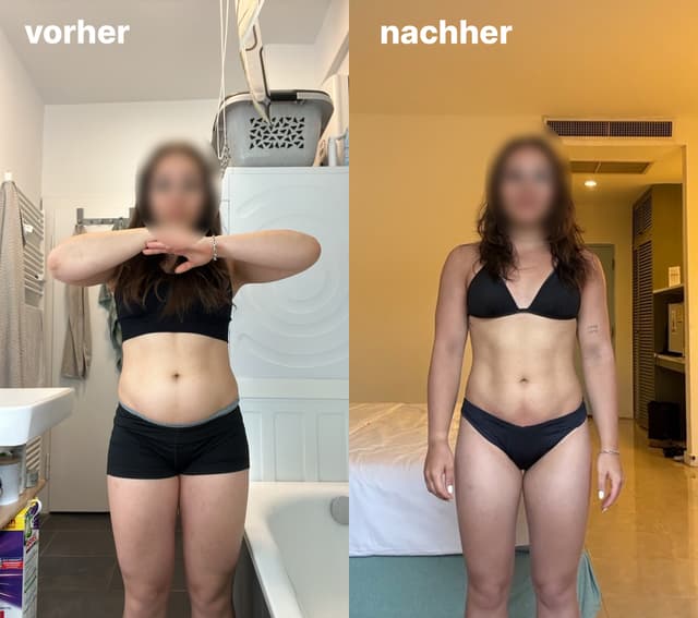 Vorher / Nachher – Front